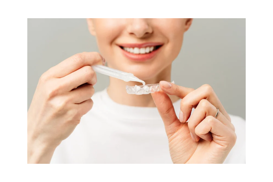Dental Genie:Custom Dental Fluoride Trays Professional Kit